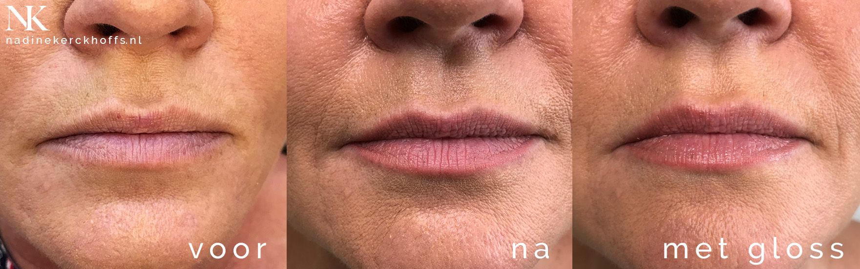 Saskia ombre lips permanente make-up Maastricht, Zuid-Limburg, Nadine Kerckhoffs